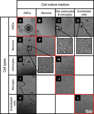 Co-cultures of Glioma Stem Cells and Primary Neurons, Astrocytes, Microglia, and Endothelial Cells for Investigation of Intercellular Communication in the Brain